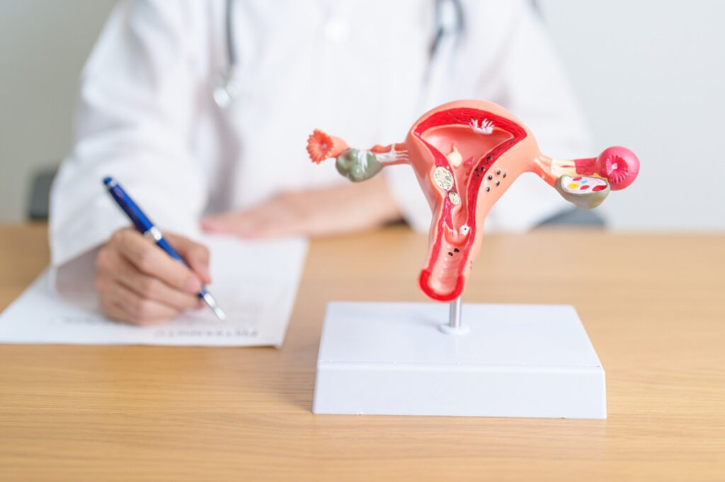 an image of a model depicting uterus